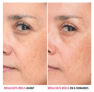 It Cosmetics Bye Bye Lines Sérum Concentré Anti-Rides à l'Acide Hyaluronique 30 ml