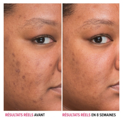 It Cosmetics Bye Bye Darkspots Sérum Anti-Taches à la Niacinamide30 ml