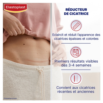 Elastoplast Réducteur de Cicatrices Xl 21 Patchs