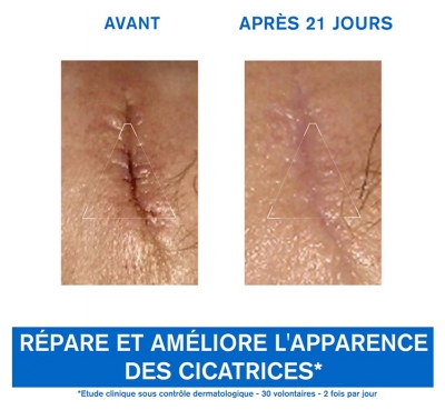 Uriage Bariéderm Cica-Crème Apaisante Réparatrice