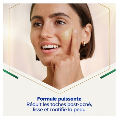 Nivea Cellular Luminous630 Sérum Marques Post-Acné Perfecteur de Peau 30 ml