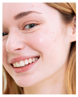 SVR Sebiaclear Crème Matifiante Anti-Imperfections SPF50+ 40 ml