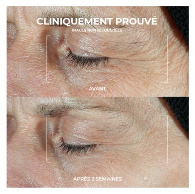RoC Derm Correxion Duo Soin Contour des Yeux Lift Anti-Rides 2 x 10 ml