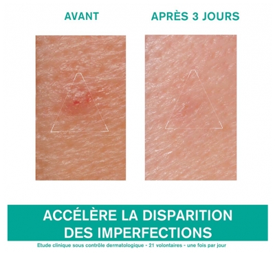 Uriage Hyséac Pâte SOS - Soin Local 15 Grammes