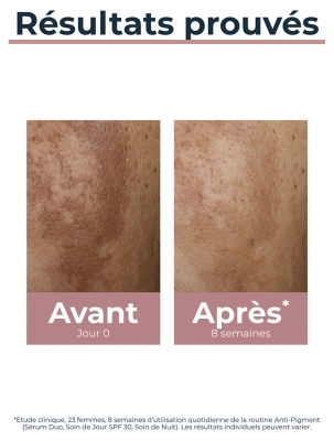 Eucerin Anti-Pigment Soin de Jour SPF 30 50 ml
