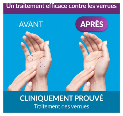Excilor Cerruxite Traitement des Verrues par Cryothérapie 50 ml