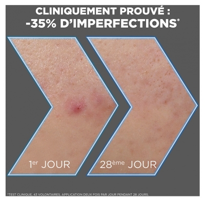 Garnier PureActive Charbon Sérum Anti-Imperfections 30 ml