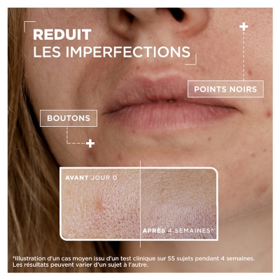 Mixa Sérum Concentré Anti-Imperfections à l'Acide Salycilique + Niacinamide Peaux à Imperfections 30 ml