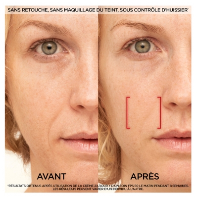 L'Oréal Paris Revitalift Laser Soin Anti-Âge Jour 50 ml