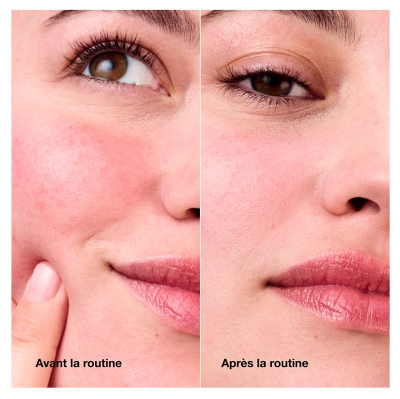 Clinique Redness Solutions Crème Quotidienne Anti-Rougeurs 50 ml