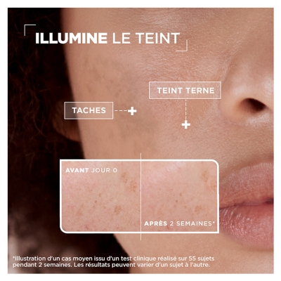 Mixa Sérum Concentré Anti Taches Vitamine C et Acide Glycolique 30 ML