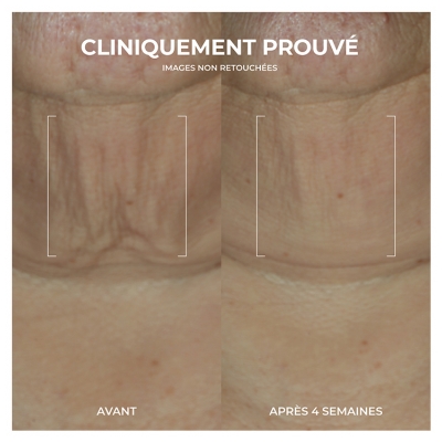 RoC Derm Correxion Serum Raffermissant au Retinol 30 Grammes