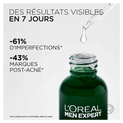 L'Oréal Paris l'Oréal Men Expert Derma Control Sérum Anti-Imperfections Niacinamide 30 ml