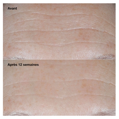 Clinique Smart Clinical Repair Crème Correctrice Anti-Rides SPF30 Toutes Peaux 50 ml