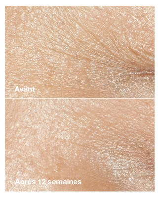 Clinique Smart Clinical Repair Crème Correctrice Anti-Rides Peptides 50 ml