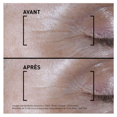 Filorga TIME-FILLER SHOT 5 XP Sérum Concentré Correction Rides d'Expression Visibles 15 ml