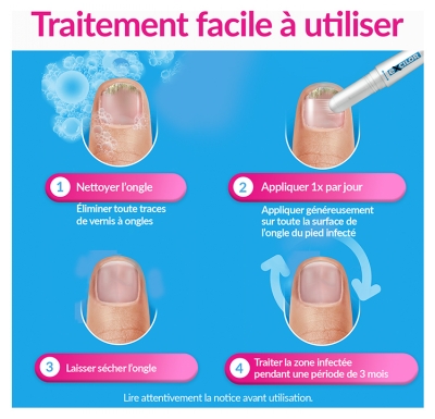 Excilor Easy Traitement Mycose de l'Ongle et Déjaunissement Actif 4 ML