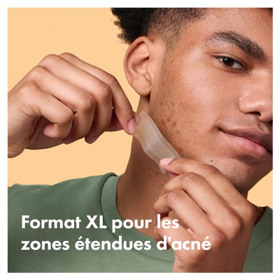 Hero – Mighty Patch Surface – Patchs Anti-Acné Jour et Nuit Pour Les Zones Étendues – Boîte de 10 Patchs