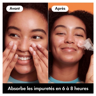 Hero Mighty Patch Nose Patchs de Nuit Anti-Imperfections 10 Unités Hydrocolloïdes