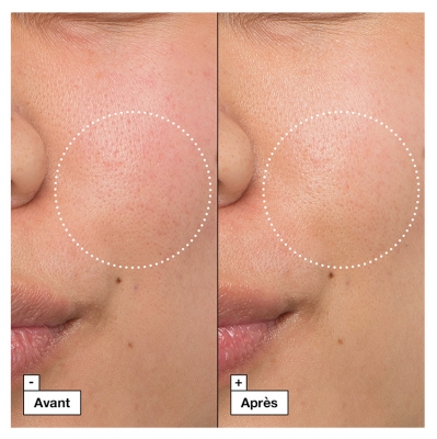 Dr. Jart+ Cicapair Crème Réparatrice Apaisante Intense 2 Complexe 50 ml