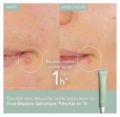 Caudalie Vinopure Stop Boutons Salicylique Peaux à Tendance Acnéique 15 ml