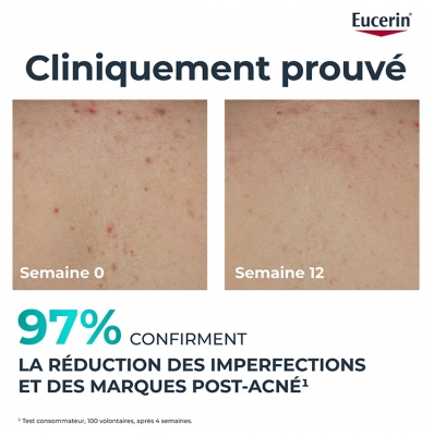 Eucerin DermoPure Clinical Crème pour le Corps Triple Action 200 ML