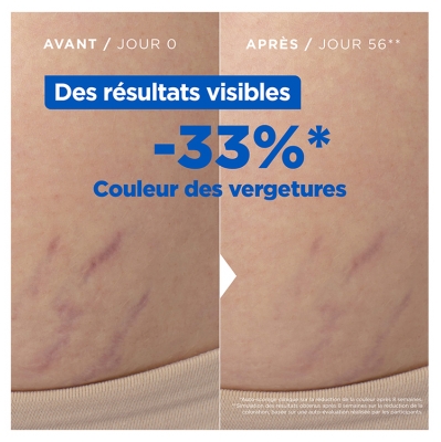 Mixa Expert Peau Sensible Huile Anti-Vergetures Oméga 6 & 9 100 ml