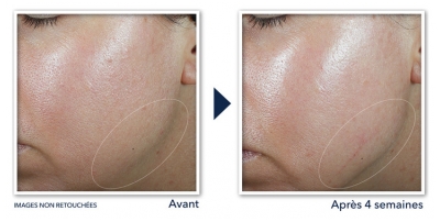 RoC Derm Correxion Crème Contour Rétinol Visage et Cou 50 ml