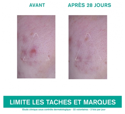 Uriage Hyséac 3-Regul + Soin Global Anti Imperfections Visage 40 ML