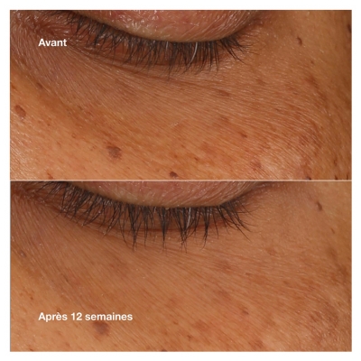 Clinique All About Eyes Sérum Concentré Illuminateur Yeux 10 ML