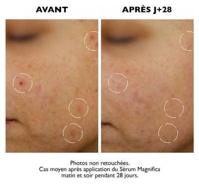 Sanoflore Magnifica Sérum Global Anti-Imperfections - 30 ml