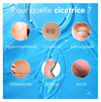 Kelo-Cote Gel pour Traitement des Cicatrices 15 g