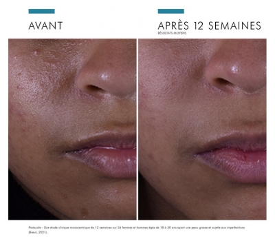 SkinCeuticals Silymarin CF Sérum Antioxydant 30 ml