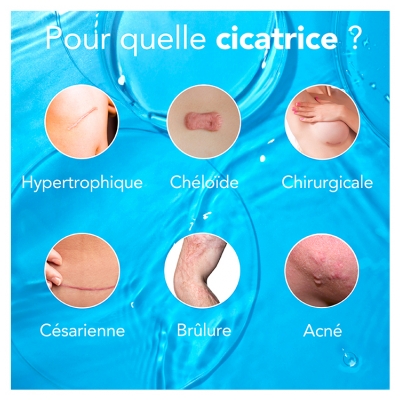 Kelo-Cote UV Gel Traitement des Cicatrices SPF30 6 g