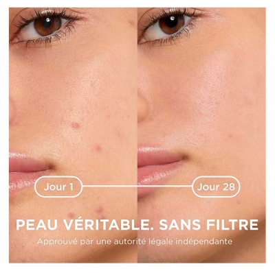 Bioderma Sébium Gel-Crème Anti-Imperfections Peaux à Tendance Acnéique 30 ml