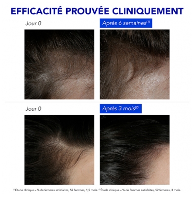Phyto Phytophanère Traitement Antichute Réactionnelle 12 Ampoules de 5 ml