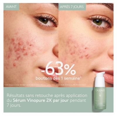 Caudalie Vinopure Sérum Anti-Imperfections 30 ml