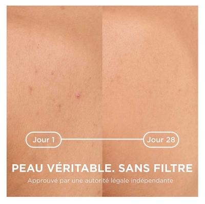 Bioderma Sébium Kerato+ Body Spray Anti Imperfections Apaisant 150 ml