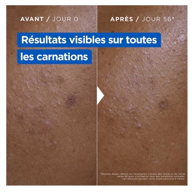 Mixa Crème Niacinamide Correction Éclat Anti-Tâches Hydratante 400 ml