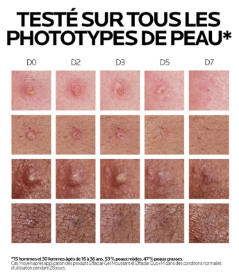 La Roche-Posay Effaclar Duo+M Soin Triple Correction Anti-Imperfections 40 ml