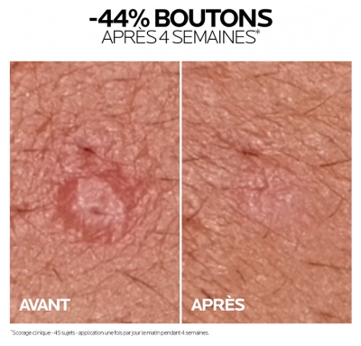 La Roche-Posay Effaclar Duo+M Soin Triple Correction Anti-Imperfections 40 ml