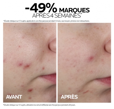La Roche-Posay Effaclar Sérum Visage Anti Imperfections 30 ml
