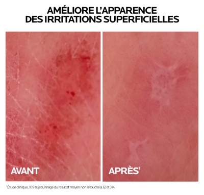 La Roche-Posay Cicaplast Baume B5+ Ultra-Réparateur Apaisant Anti-Marques 40 ml