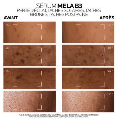 La Roche-Posay Mela B3 Sérum Anti-Taches 30 ml