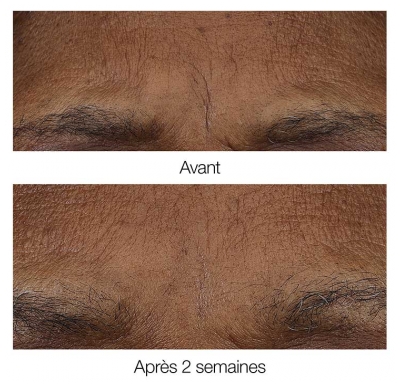Clinique Smart Clinical Repair Baume Rétinoïde Matin/Soir 3 Grammes