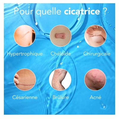 Kelo-Cote Gel Pour Cicatrices 30 g