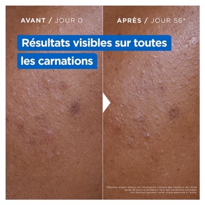 Mixa Crème Niacinamide Correction Éclat Hydratante Anti-Tâches 400 ml 