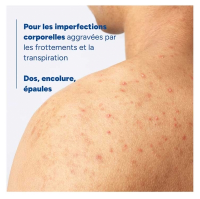 Ducray Keracnyl Spray Corps Asséchant Anti-Boutons Dos Bustes et Épaules 150 ml