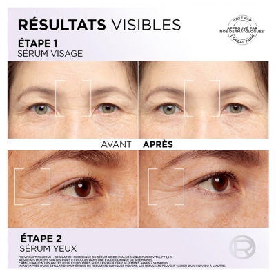L'Oréal Paris Revitalift Filler Hyaluron Sérum Rides et Hydratation Visage 30 ML