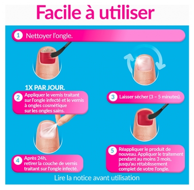 Excilor Forte Traitement Mycose de l'Ongle Coloré + Vernis Classique Coloré Avec Pinceau Applicateur 30 ml